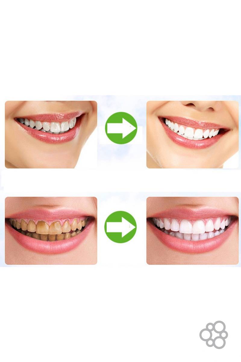 Отбеливание зубов углем. Отбелить зубы активированным углем. Отбеливание зубов активированным углем до и после.